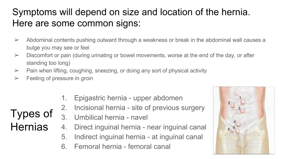 Hernia Surgery